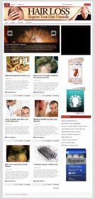 Hair Loss PLR Niche Blog small