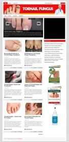 Toenail Fungus PLR Niche Blog small